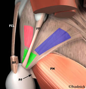 Posterolateral Corner Injury - Radsource
