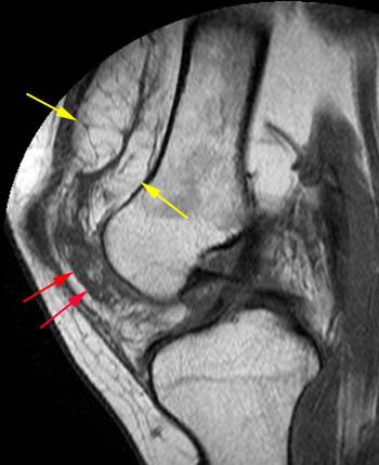 301 Moved Permanently