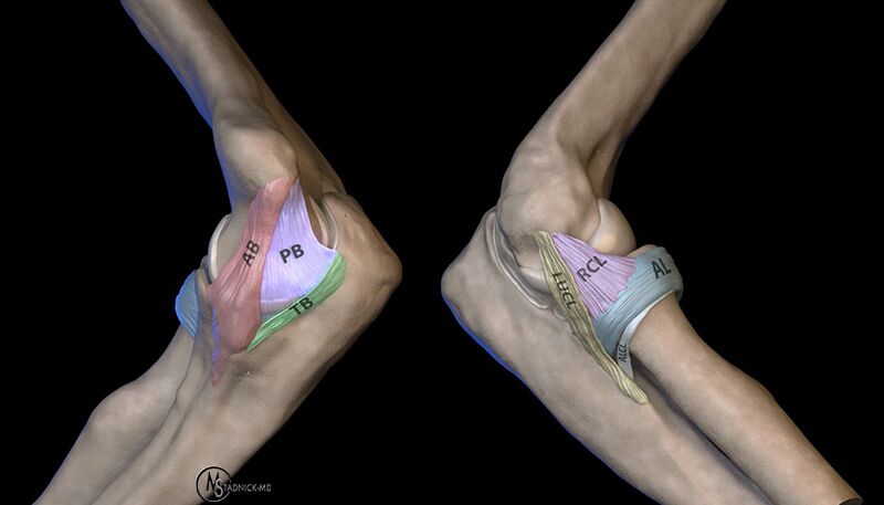 Posteromedial Rotatory Instability of the Elbow - Radsource