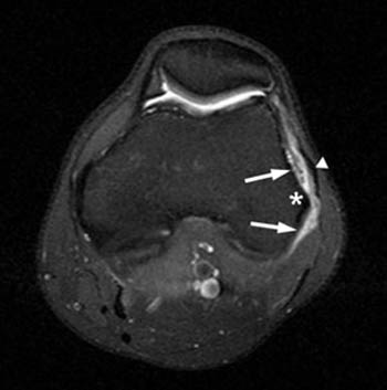 prostate volume normal range radiology 2 frakció ízületi kezelés