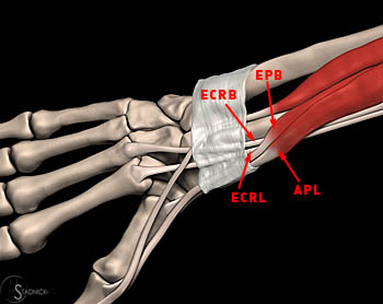 Tendon Intersection Syndromes - Radsource diagram of tendons in forearm 