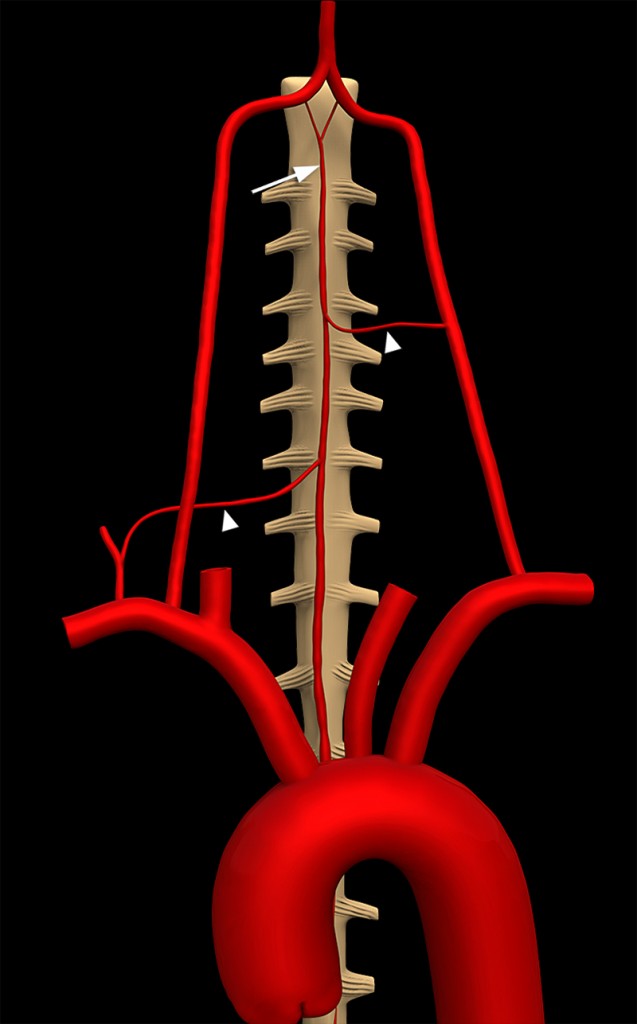 Anterior Spinal Artery