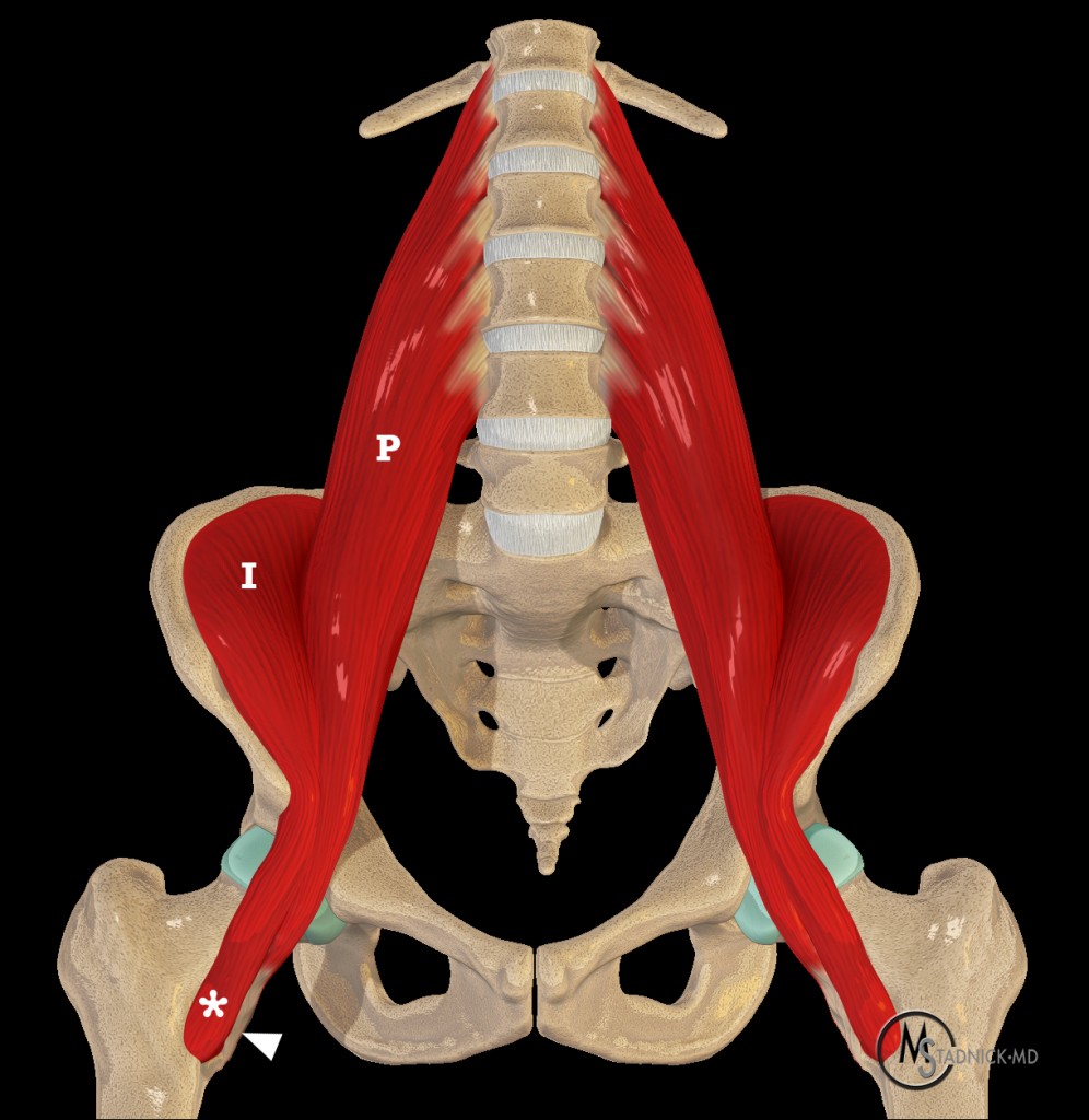 The psoas (P) and iliacus (I) muscles