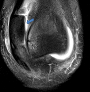 anterior coronal image