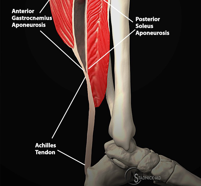 A calf strain can occur in either your gastrocnemius or soleus