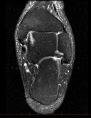 Gentagen Gentage sig Trunk bibliotek Atypical Scan Angles in Musculoskeletal MRI - Radsource
