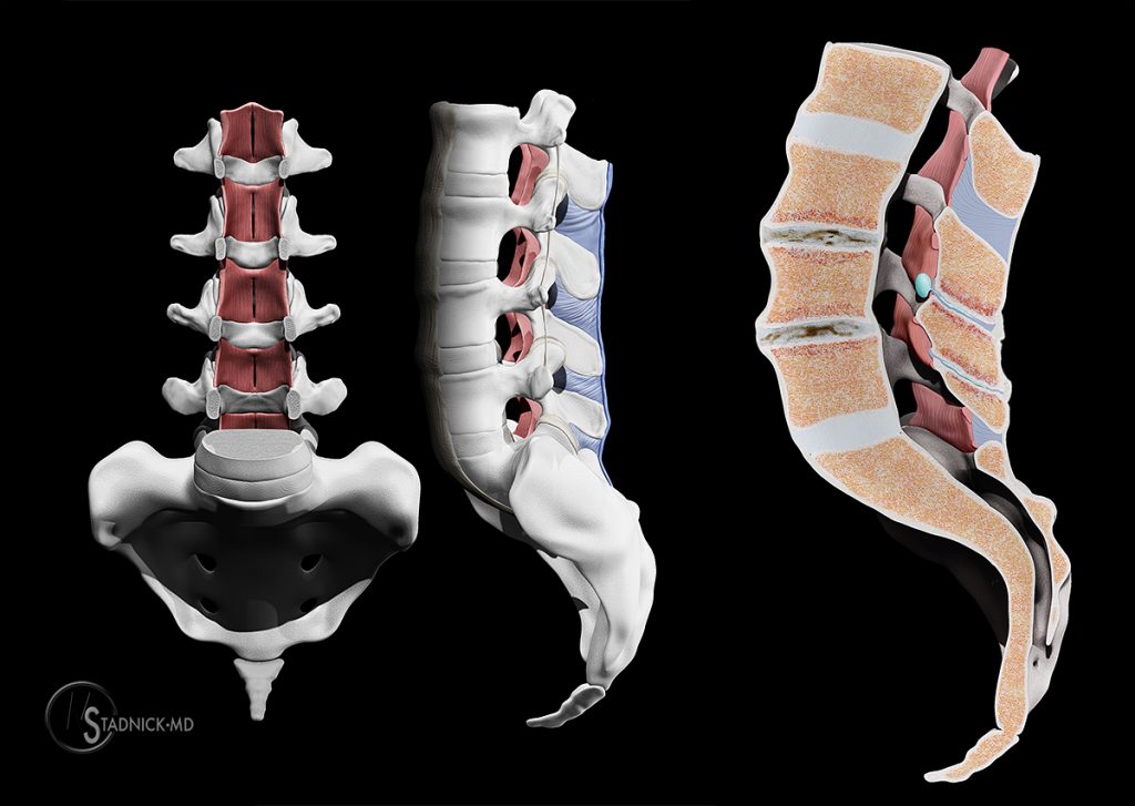 lumbar spine, figure 3