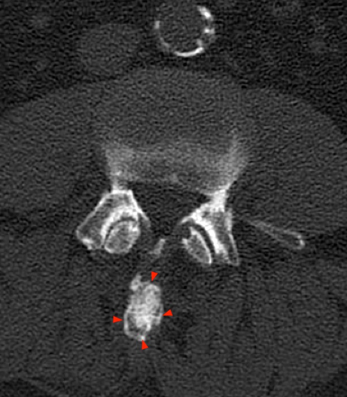 Axial CT image, 5b