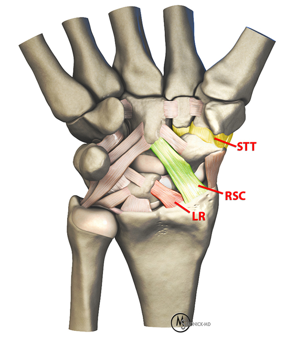 interosseous ligament hand