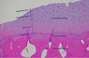 Histologic image of articular cartilage