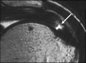 Medical images: Diagram and coronal T2-weighted MR images