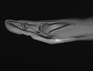 Medical image - right foot