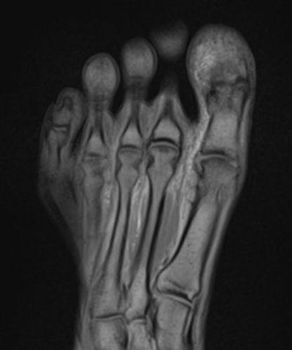 Medical image - right foot