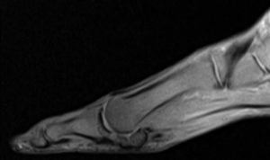 Medical image - foot