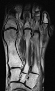 Medical image - foot