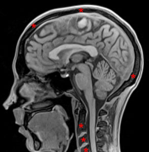 Medical image - brain and upper cervical spine