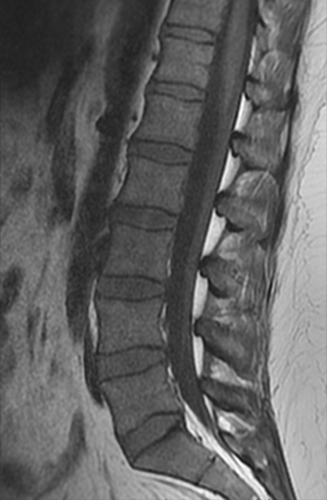 Medical image - spine