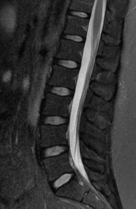 Medical image - spine