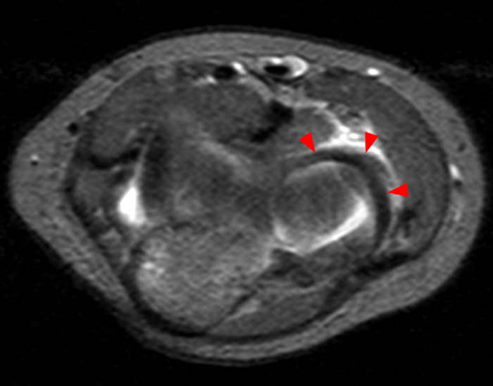 Axial T2-weighted image