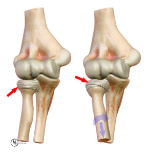 3D illustration of elbow