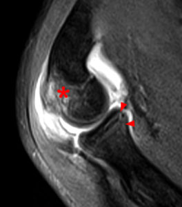 T2-weighted sagittal image