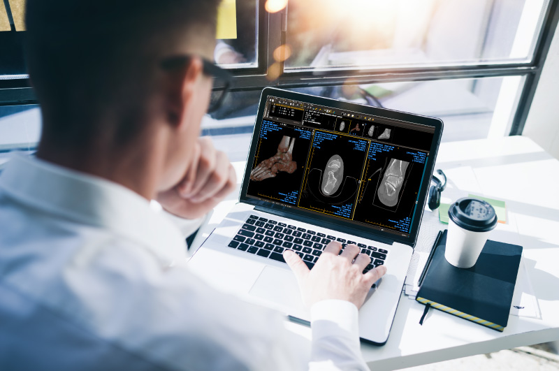 a view over the shoulder of a doctor at a macbook laptop viewing several medical images using the ProtonPACS software