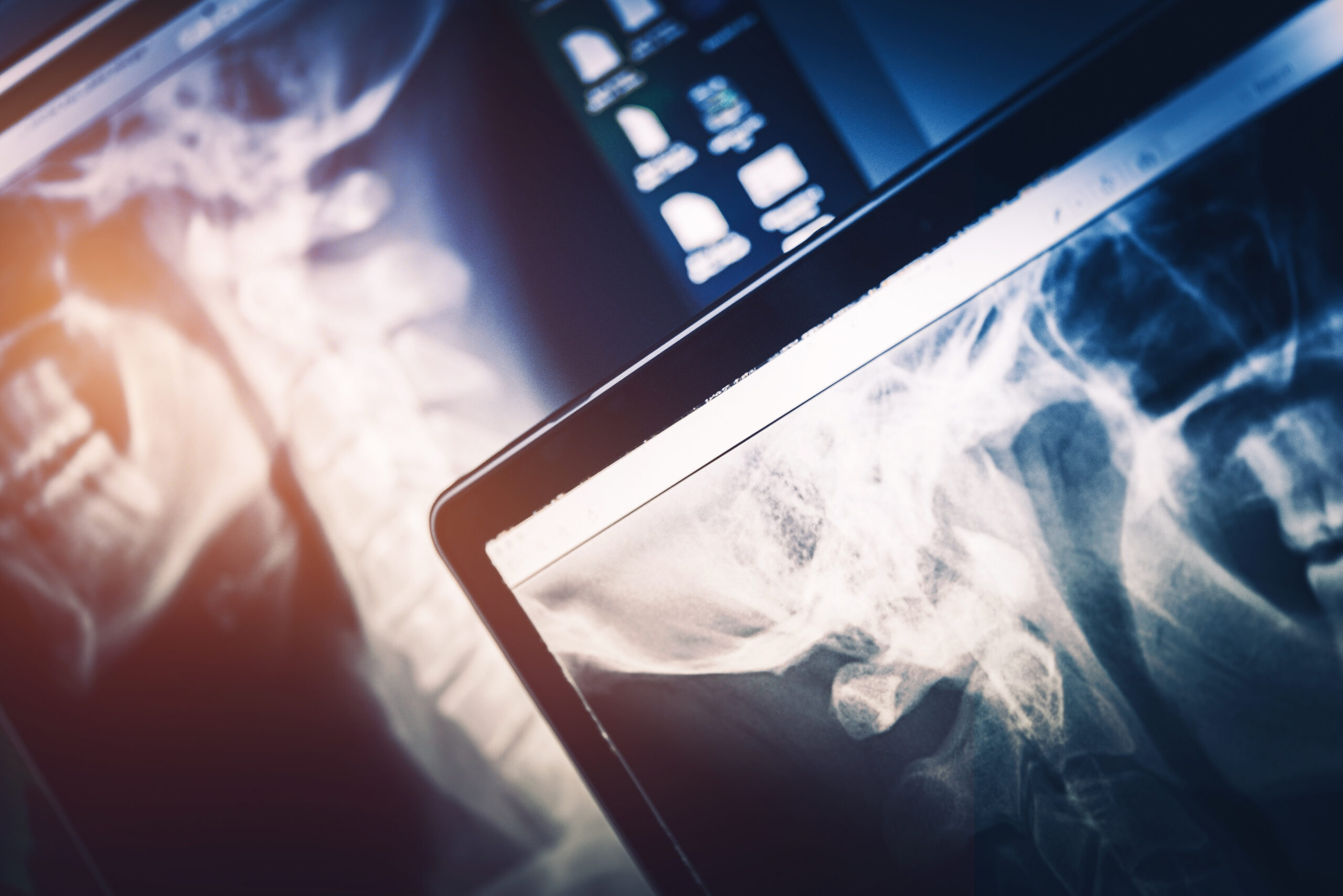 How Subspecialty MRI Reads Help IDTFs Compete with Hospital Systems